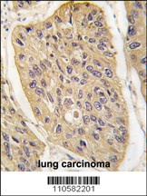 WIF1 Antibody