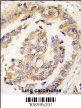 OLFM1 Antibody