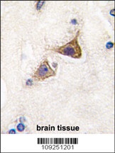 Junctophilin 3 Antibody