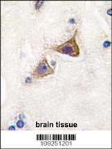 Jph3 Antibody