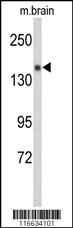 Semaphorin 5A Antibody