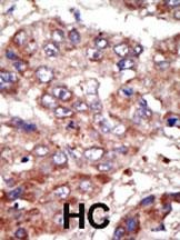 FACL6 Antibody