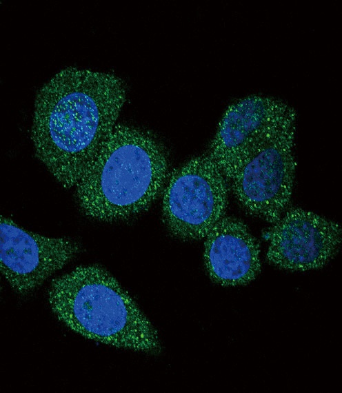 ACSL4 Antibody