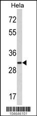 MARCKS Antibody
