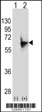 NMT2 Antibody