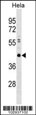 CBX8 Antibody