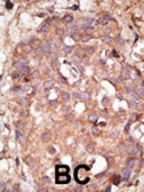 NYREN18 Antibody