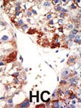 NYREN18 Antibody