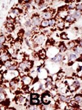 GPI8 Antibody