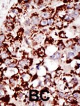 PIGK Antibody