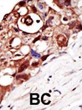 GPI8 Antibody