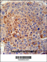 GPLD1 Antibody