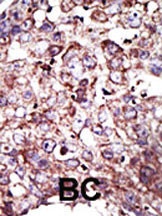 FNTA Antibody