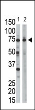 RPN1 Antibody