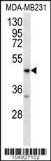 AGER Antibody