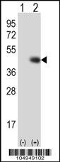 TPST1 Antibody