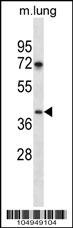 TPST1 Antibody