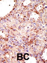 ARFGAP1 Antibody