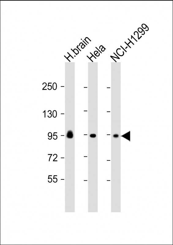 GALC Antibody