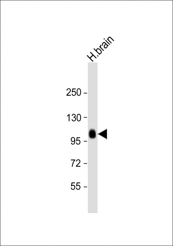 ADAMTS17 Antibody