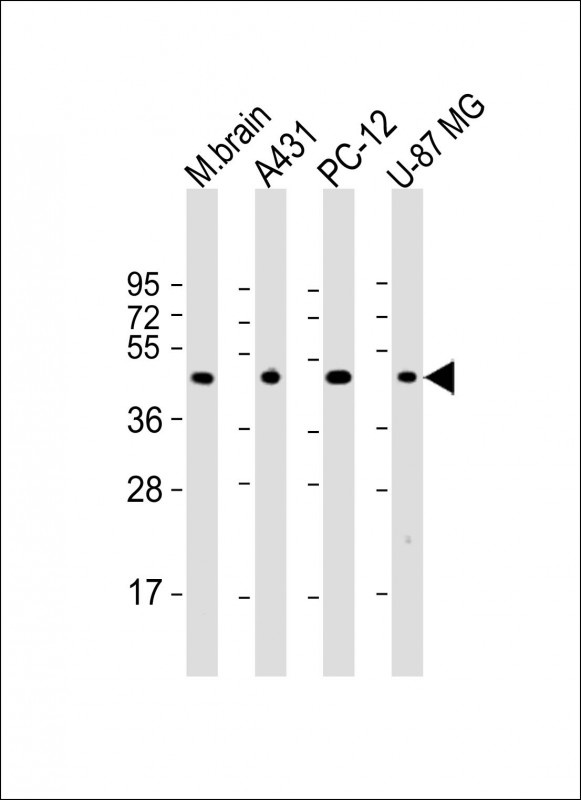 THRA Antibody