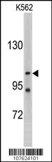 LLGL2 Antibody
