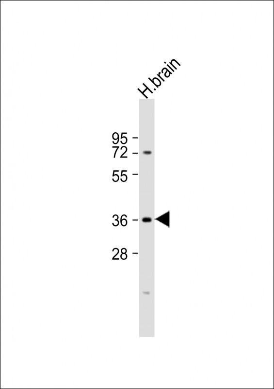 NMNAT1 Antibody