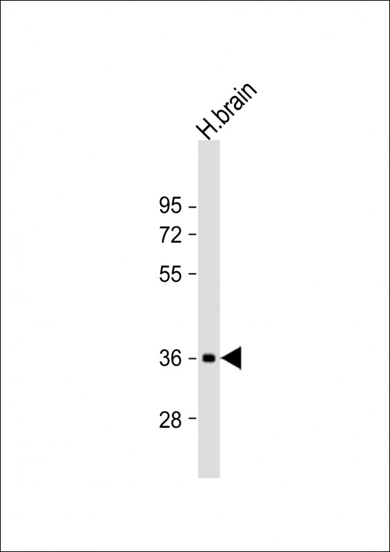 NMNAT1 Antibody