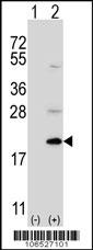 UFC1 Antibody