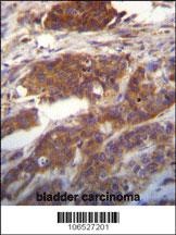 Ufc1 Antibody
