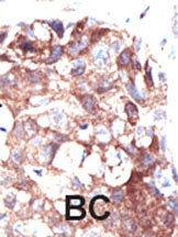 Ubiquilin1 Antibody