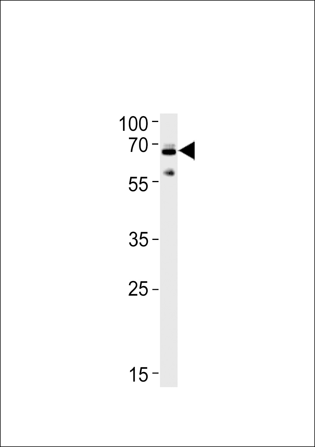 UBQLN1 Antibody