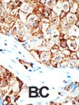 Ubiquilin1 Antibody