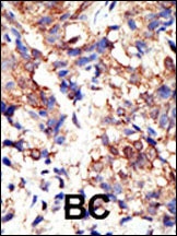 UBQLN2 Antibody