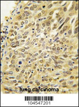 UBQLN2 Antibody