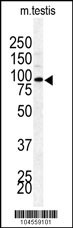 BAP1 Antibody