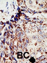 BAP1 Antibody