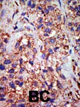 USP8 Antibody