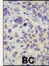 USP8 Antibody