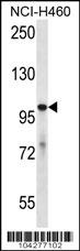 USP6 Antibody