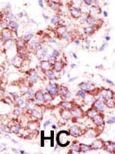 USP4 Antibody