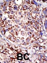 USP3 Antibody