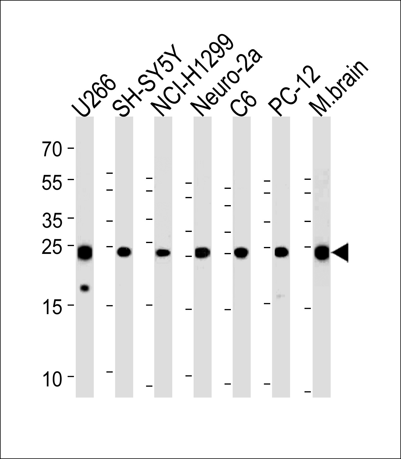 UCHL1 Antibody