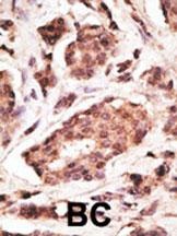 UCHL1 Antibody