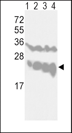 UCHL1 Antibody