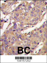 UBE2L6 Antibody