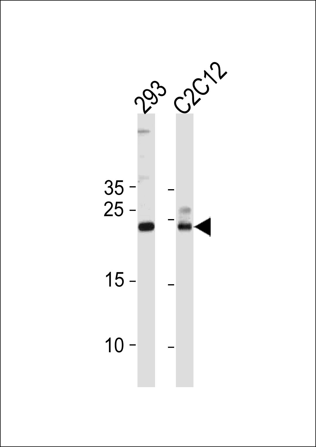 UBE2K Antibody