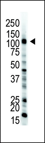 E1 Ubiquitin Antibody