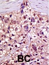 E1 Ubiquitin Antibody