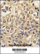 E1 Ubiquitin Antibody